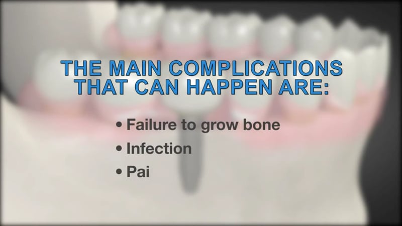 What is a Dental Bone Graft
