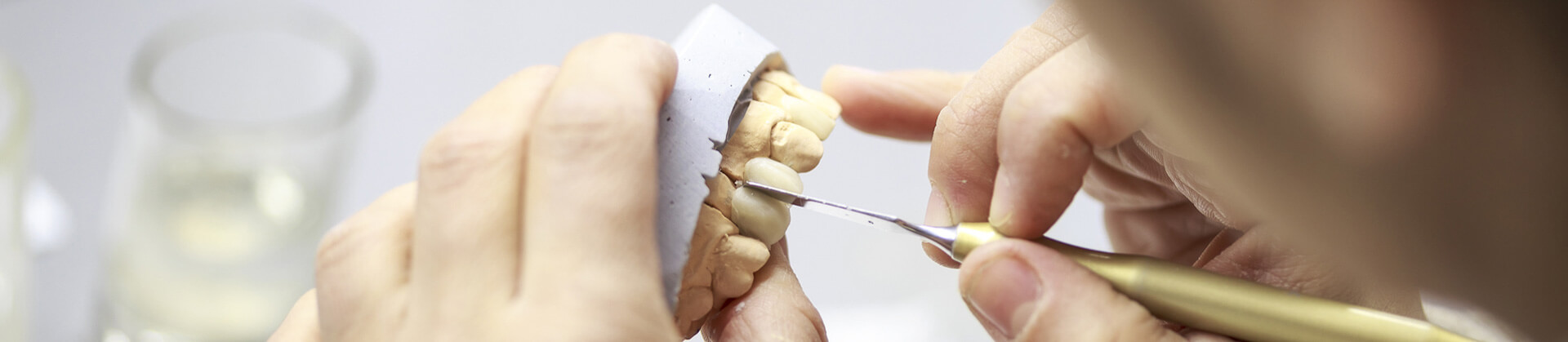 Closeup of dental prosthetic being examined