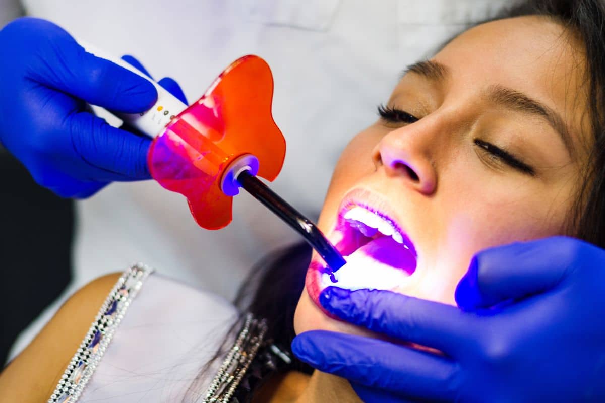 Professional teeth whitening treatment for a brighter smile.