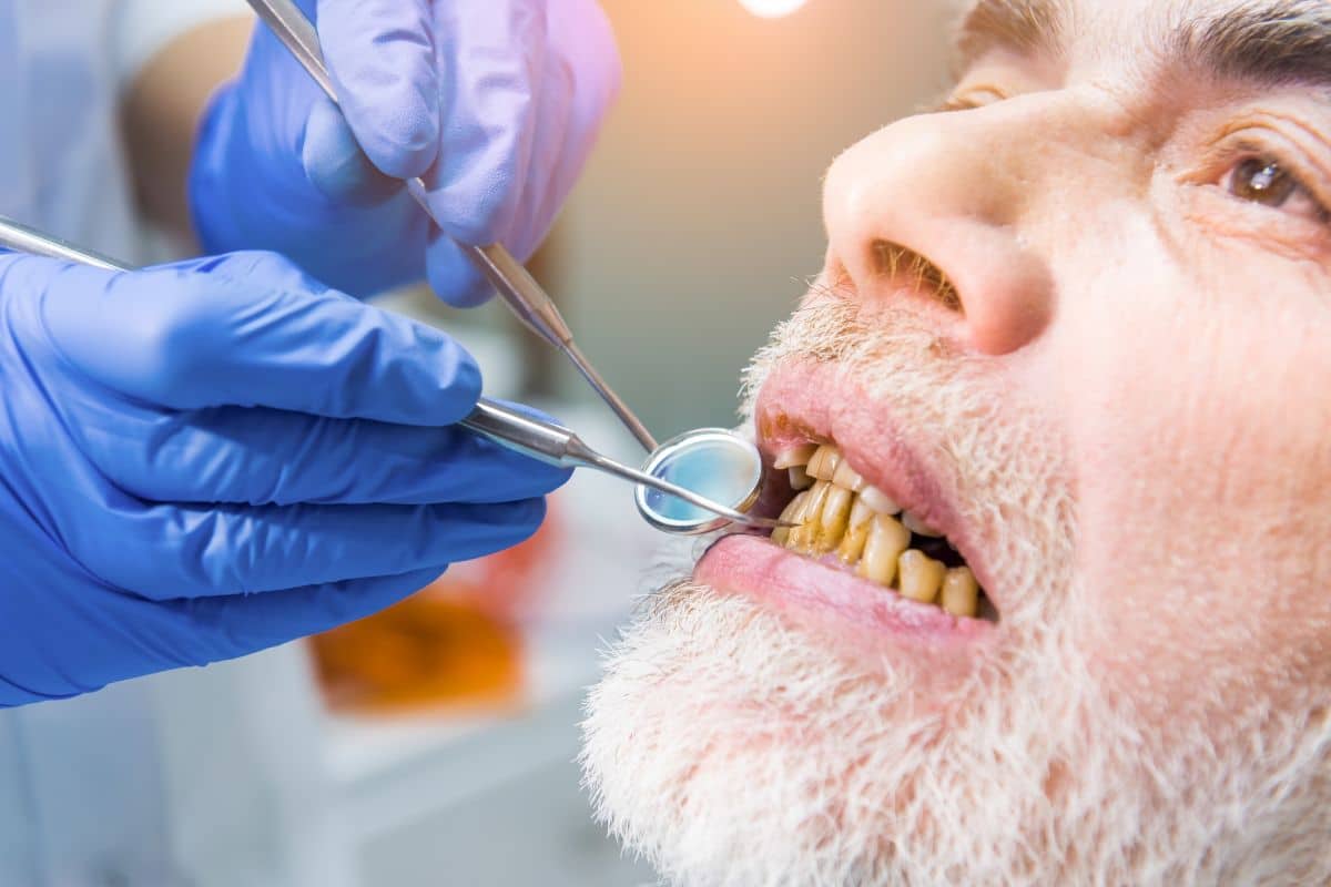 Patient with tobacco-stained teeth receiving a professional dental examination for cosmetic treatment.