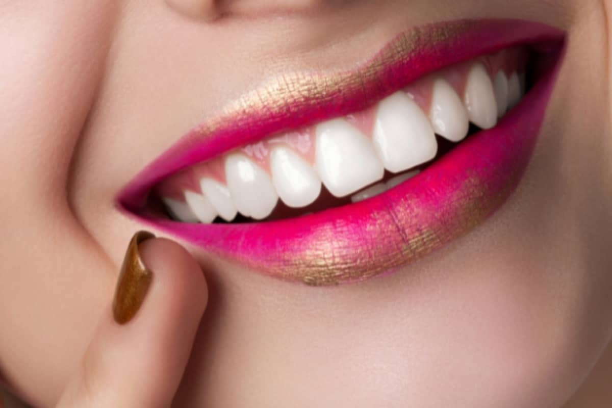 Close-up of a smile showing chipped and uneven teeth before dental bonding