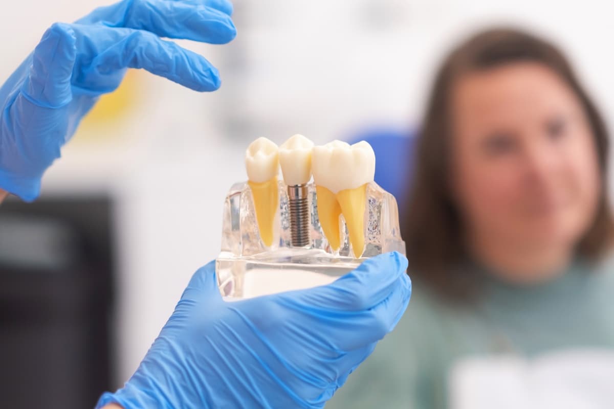 Dental implant model showing a replacement tooth and jawbone support for health.