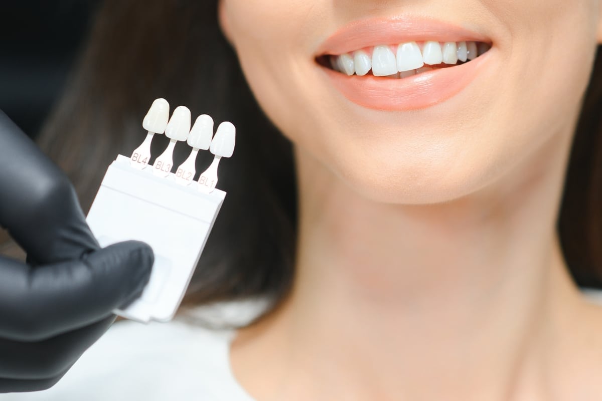 Woman smiling while dentist matches tooth shade for cosmetic dental treatments