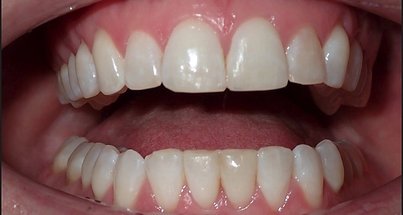 img beautiful male smile after
