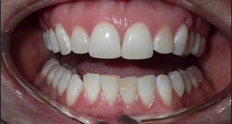 img beautiful male smile before
