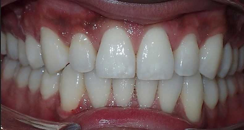 img dental smile after