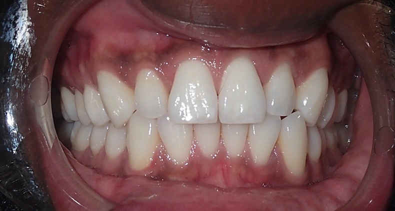 img dental smile before