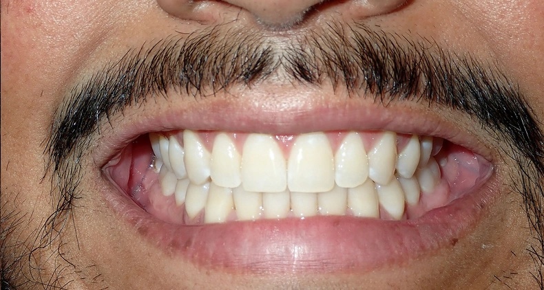 img healthy smile dental after