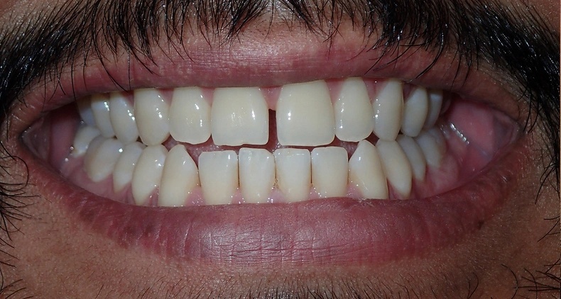 img healthy smile dental before